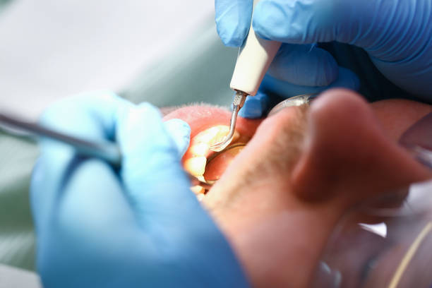 Best Cracked Tooth Emergency Dentist  in Basile, LA