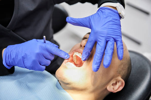 Best Emergency Dentist No Insurance  in Basile, LA